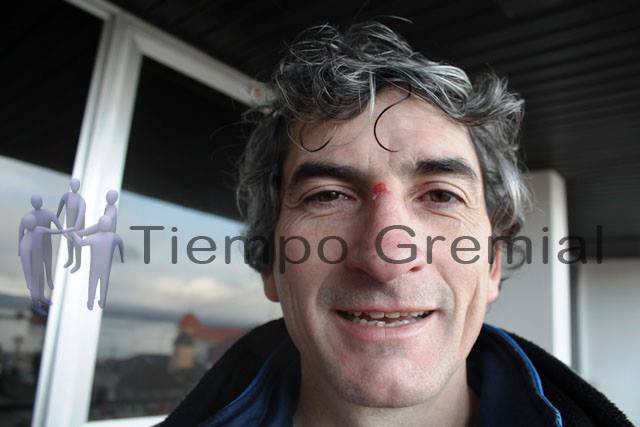 Rene_Massa_golpeado